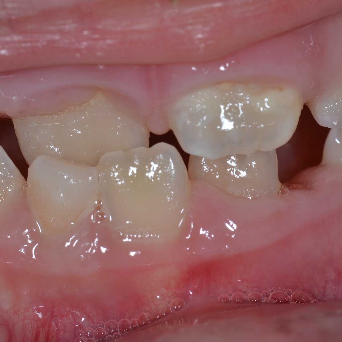 Gianluigi Bittante-21