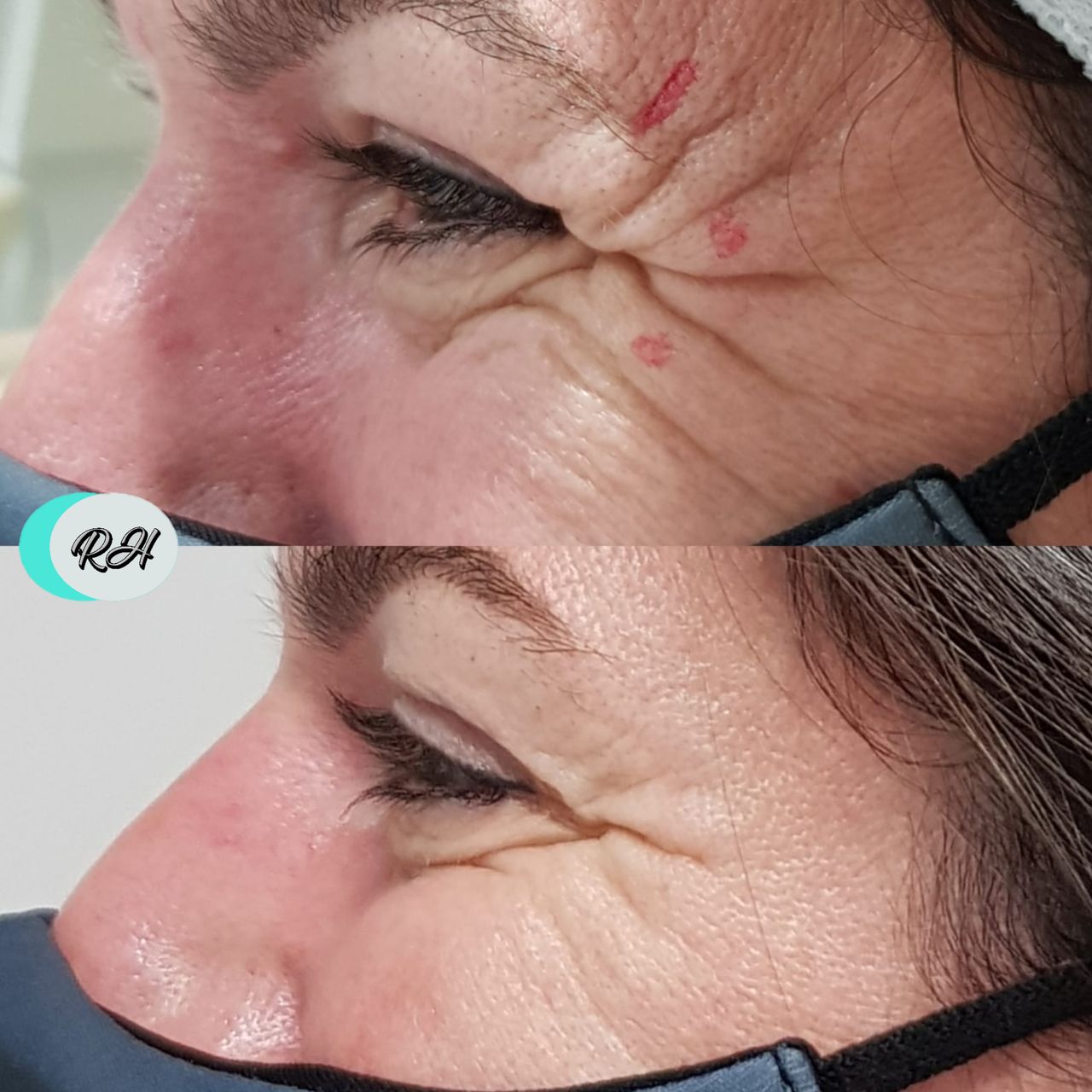 Rosalba Herrero Zerpa-141