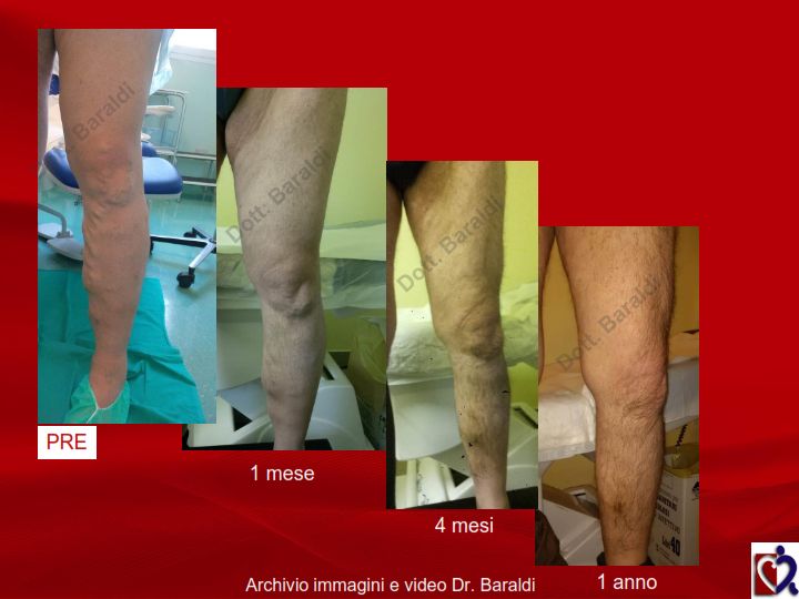 Christian Baraldi-12