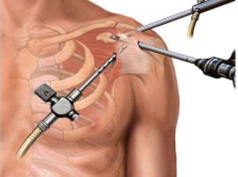 Pierpaolo Santoro-12