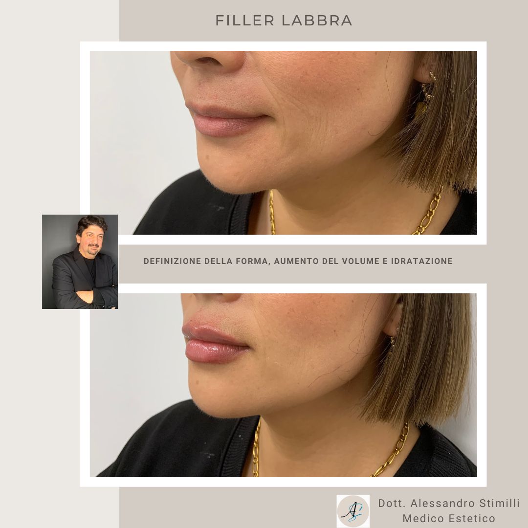 Alessandro Stimilli-13