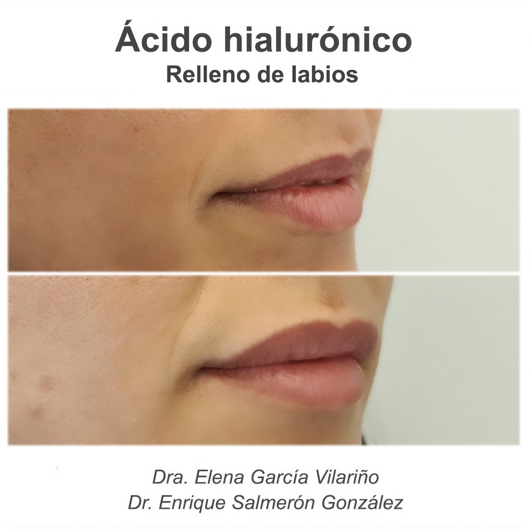 Enrique Salmerón González-81