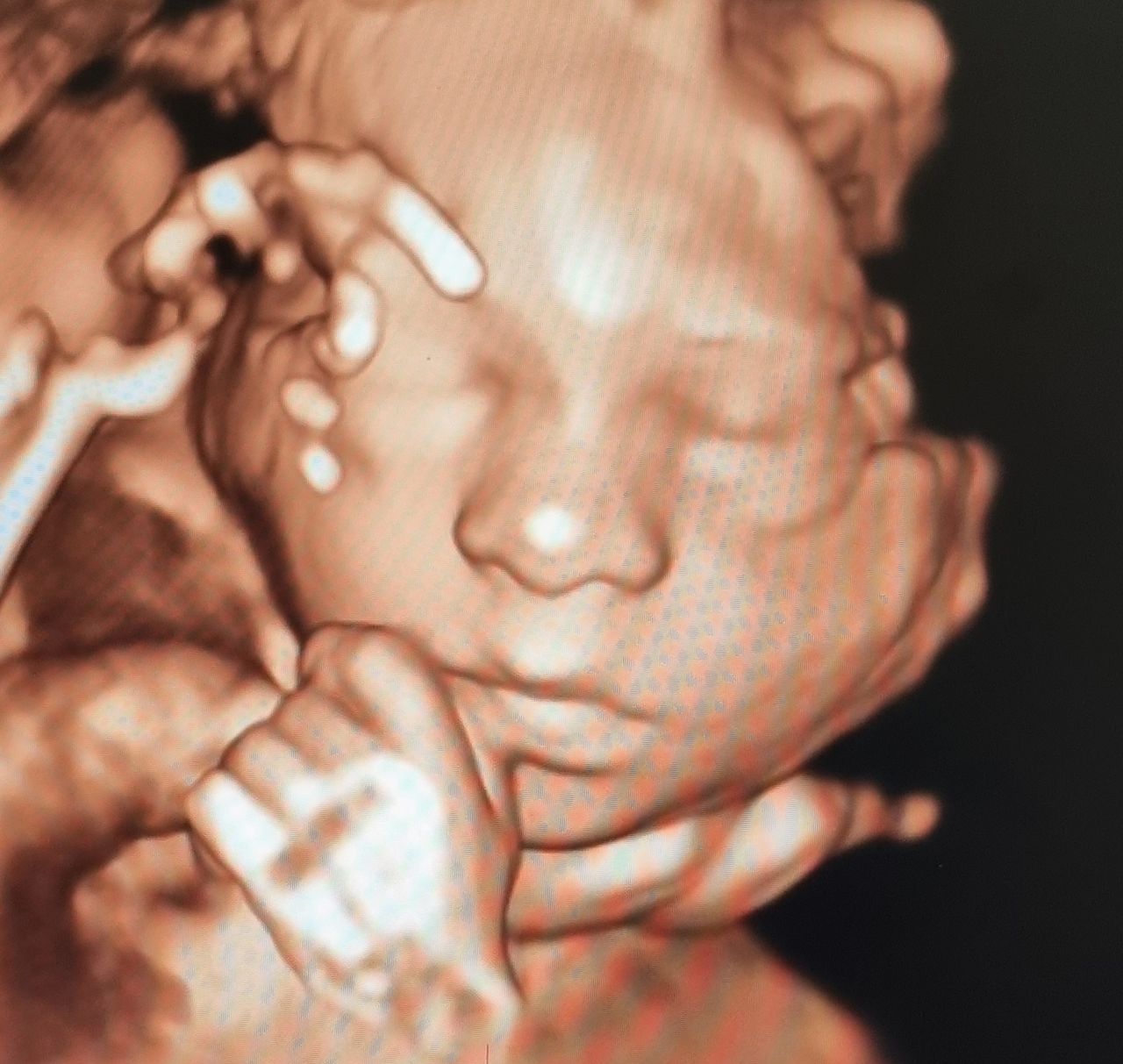 Michela Bernassola-0