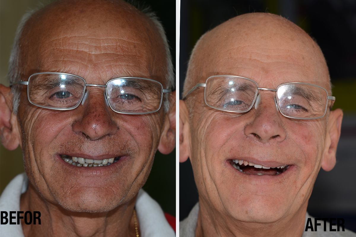 Alessandro Palumbo-35