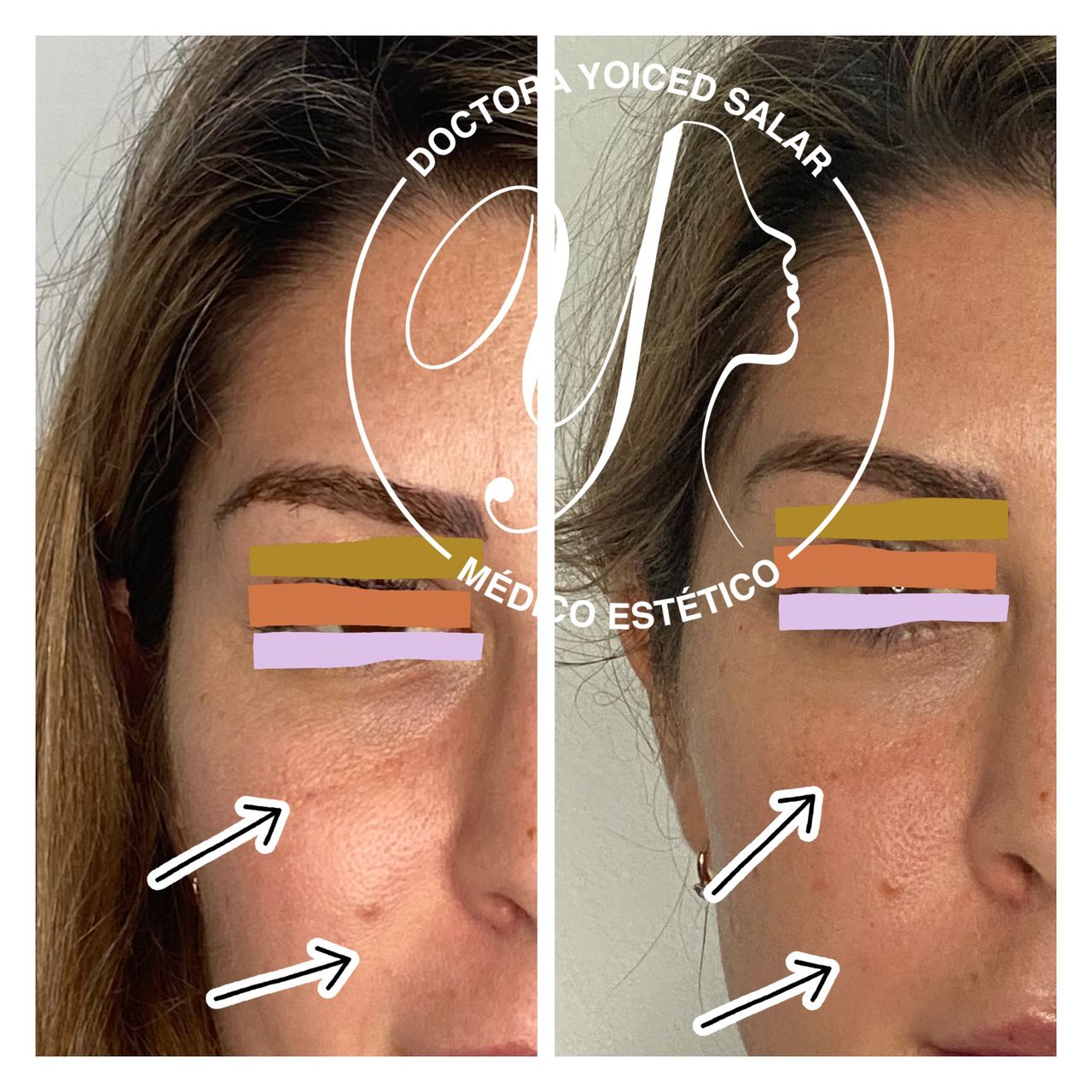 Yoiced Salar Peñate-12