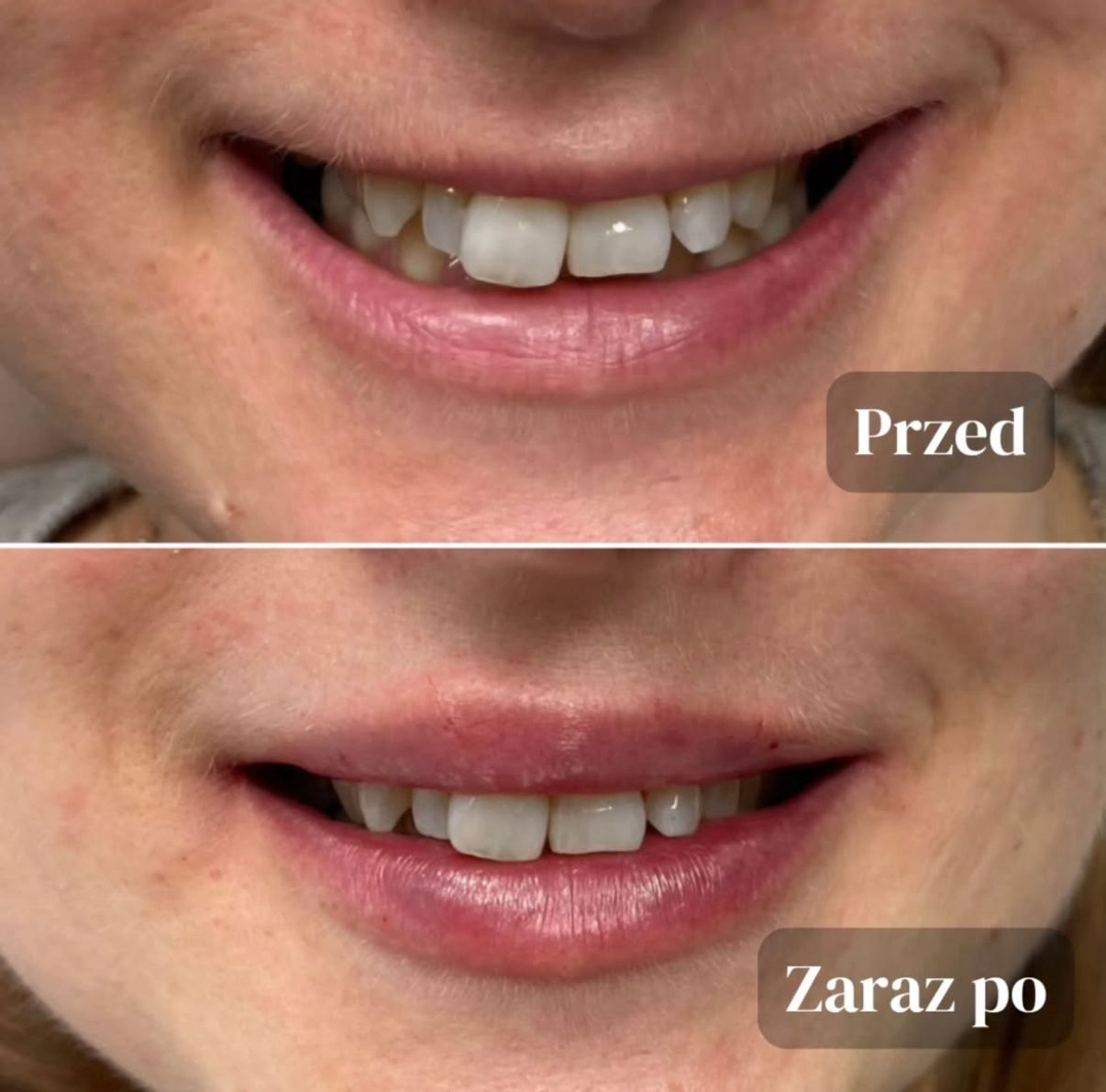 Aleksandra Kowalczuk-14