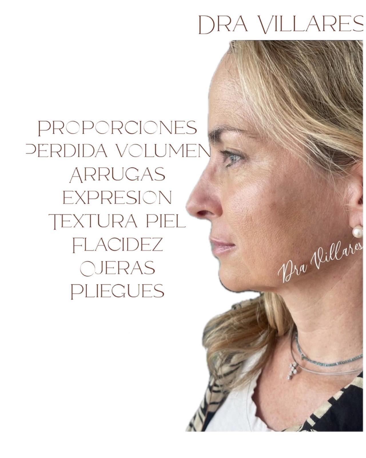 Maria Jose Villares Moreno-11