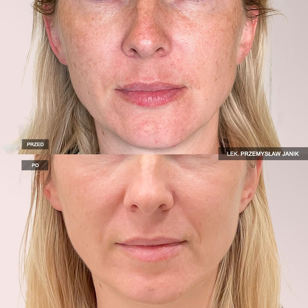 Przemysław Janik-43