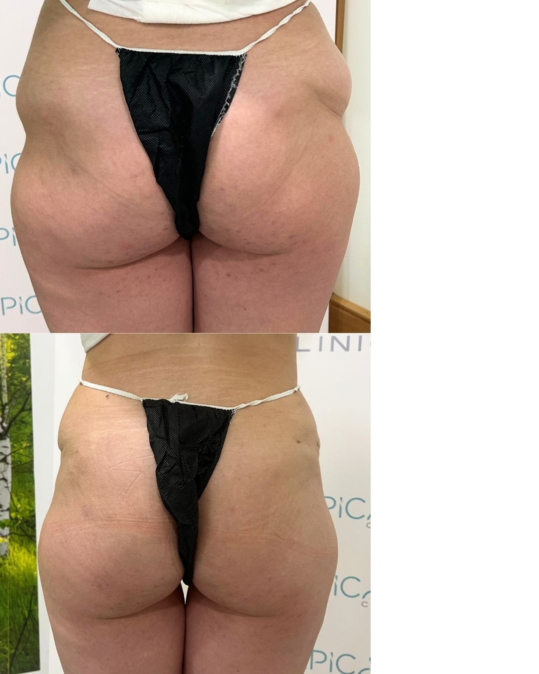 Juan Francisco Belén Montero-36