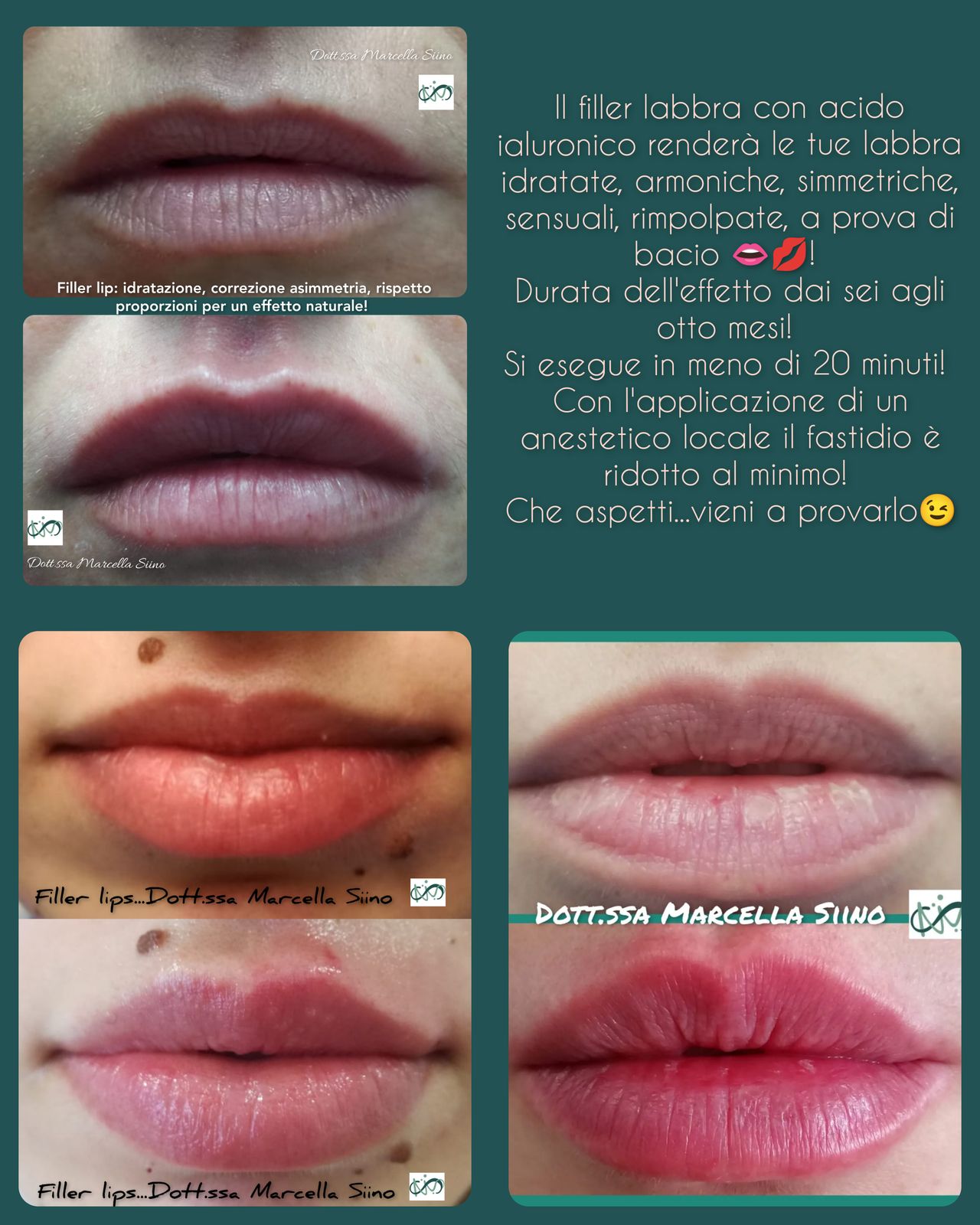 Marcella Siino-0