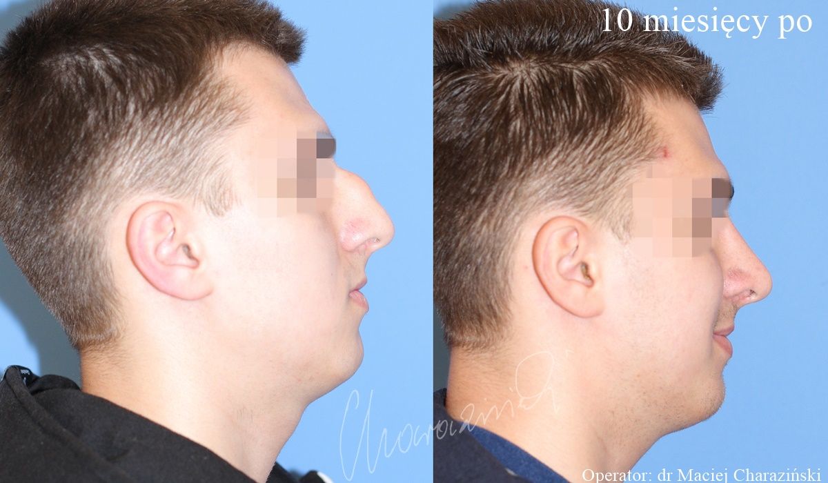 Maciej Charaziński-40