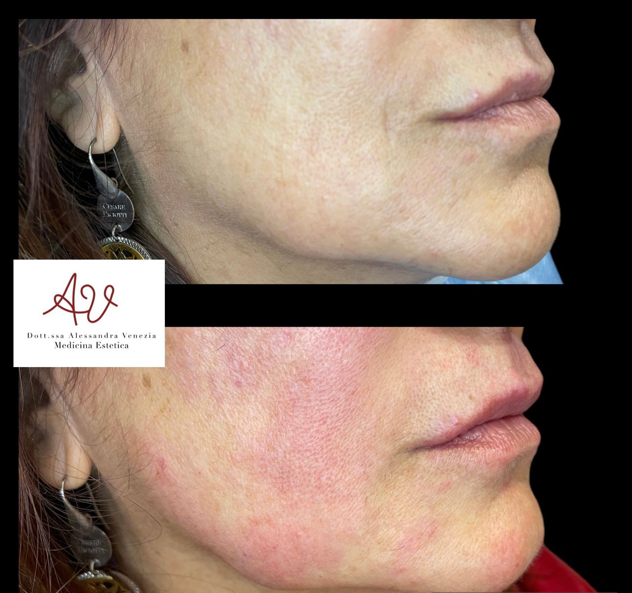 Alessandra Venezia-8