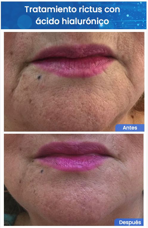 Juan Enrique Pérez Enríquez-144