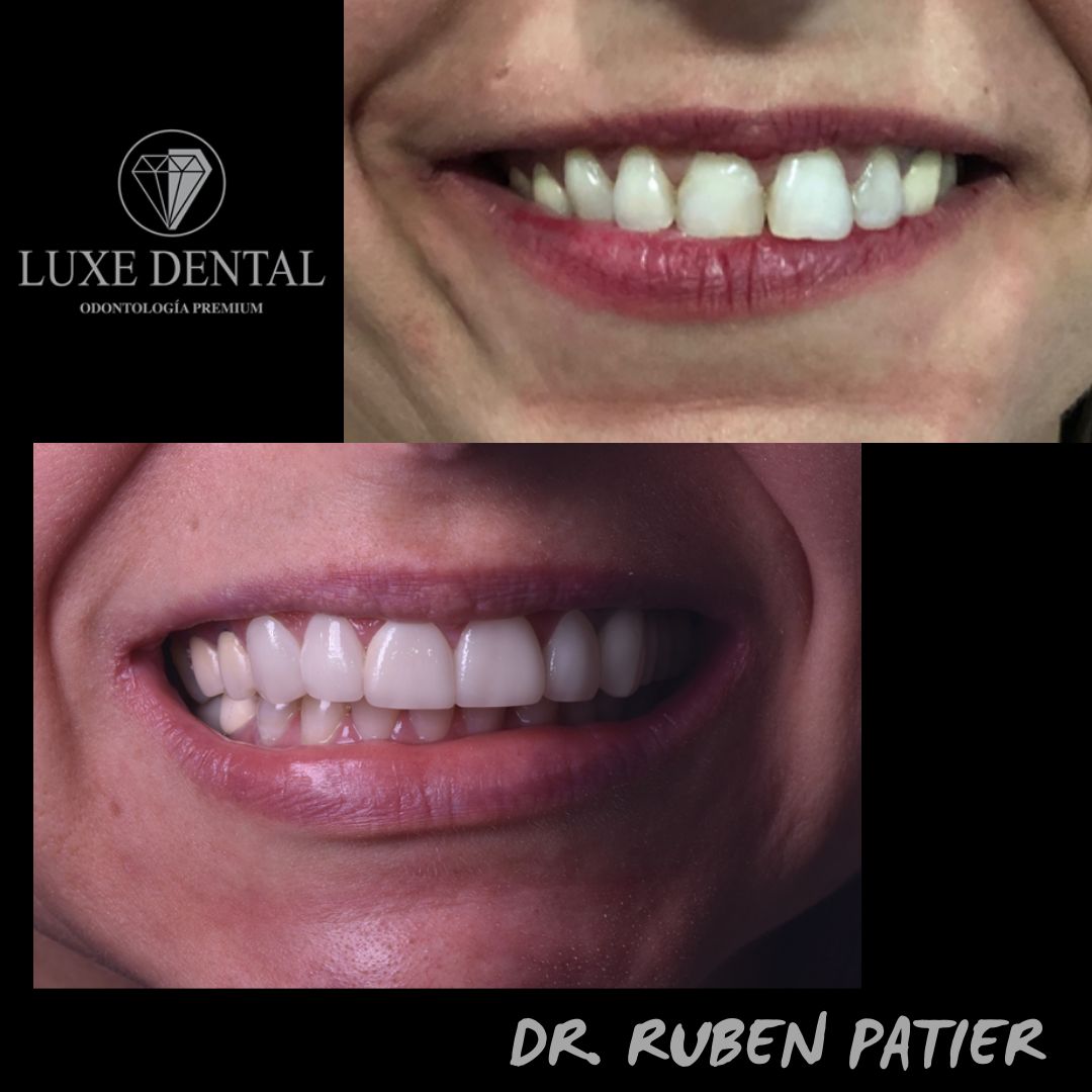 Ruben Patier Martin-32