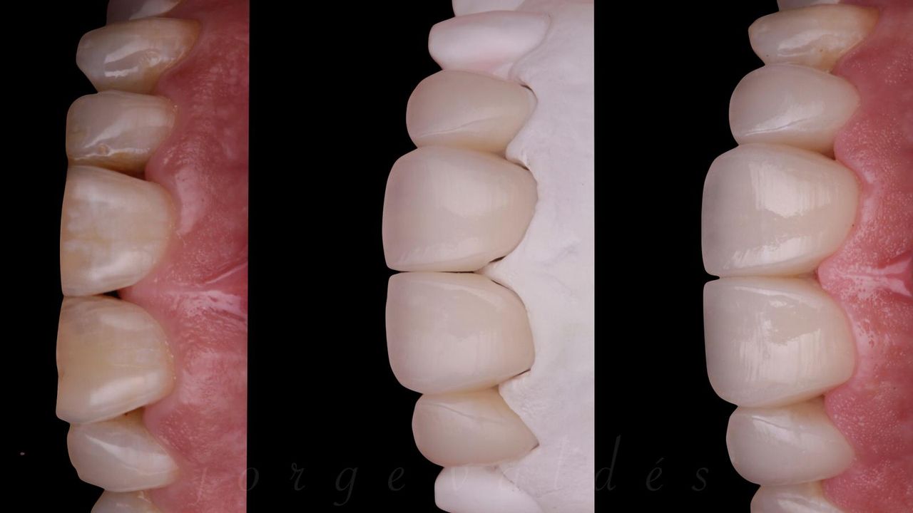 Gonzalo Navarro Boto-6