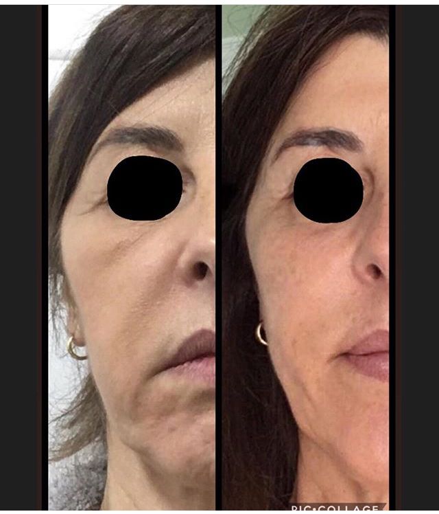 Olane Guergue Diaz De Cerio-6