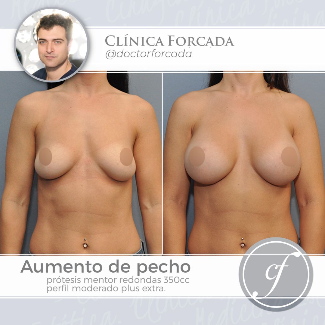 Eduardo Forcada Melero-4