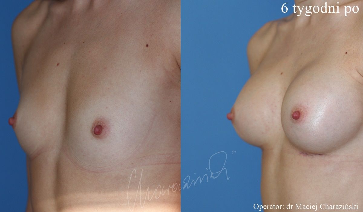 Maciej Charaziński-89