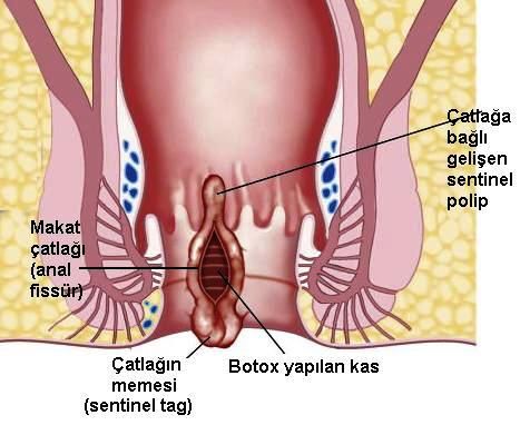 Nurullah Burak Korkmaz-6