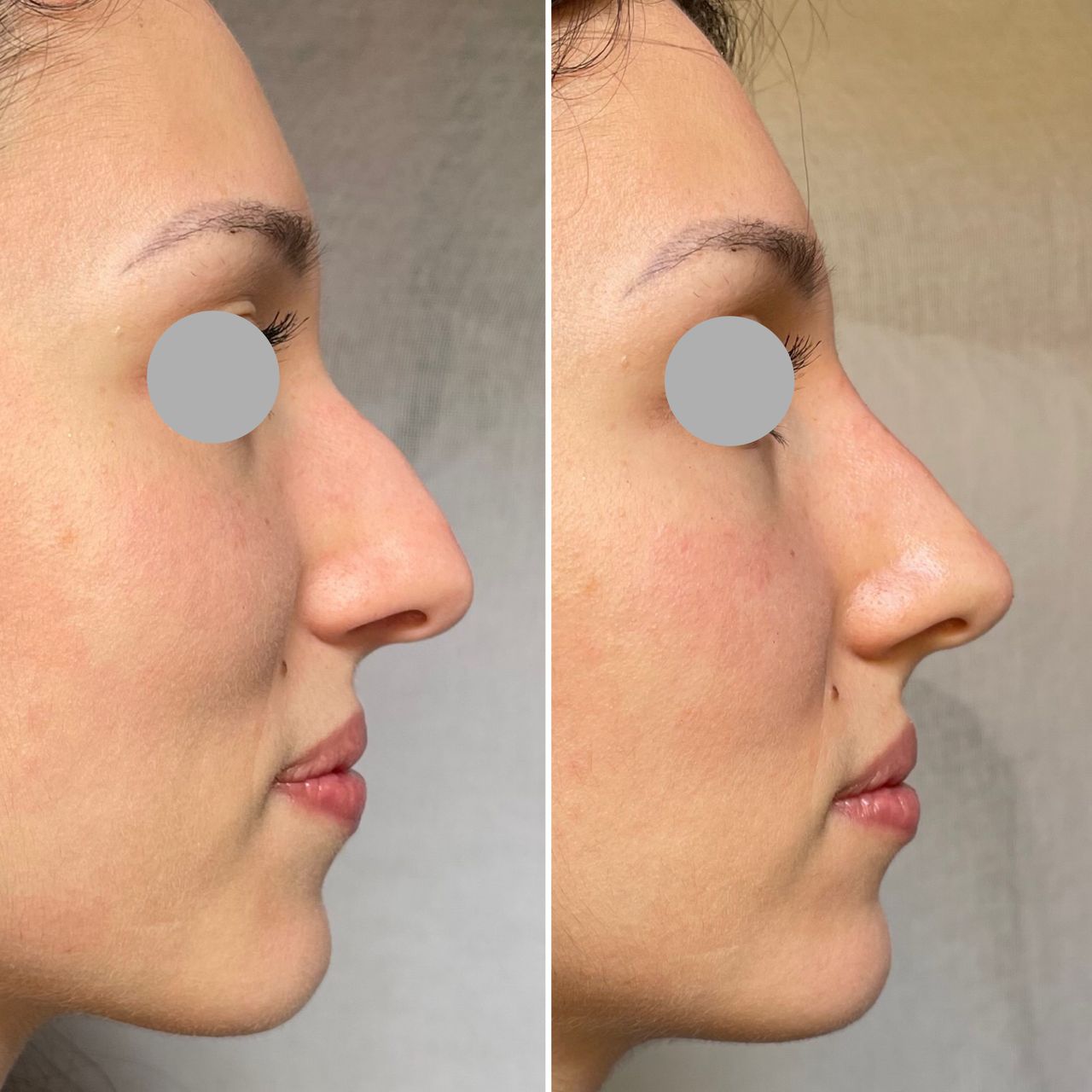 Leonardo Scortecci-21