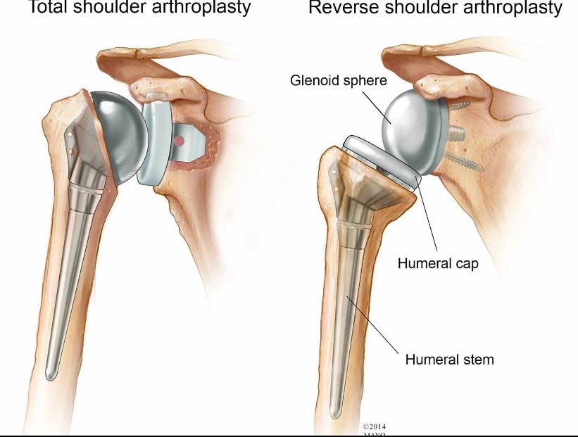 Pierpaolo Santoro-10