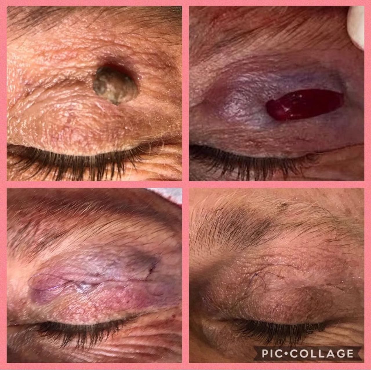 Angelo De Cataldis-3