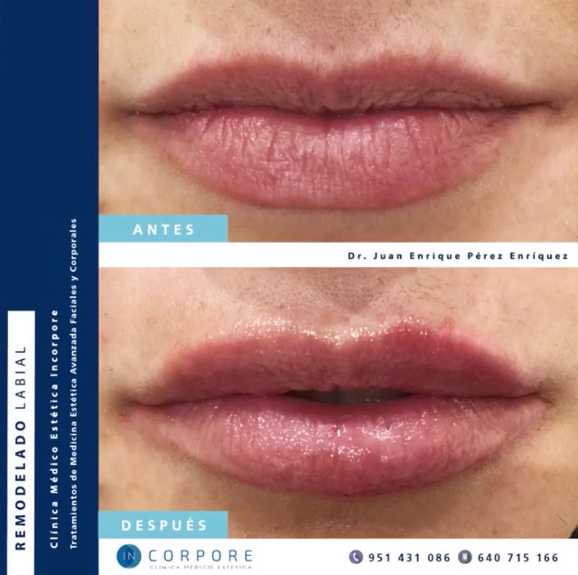 Juan Enrique Pérez Enríquez-121