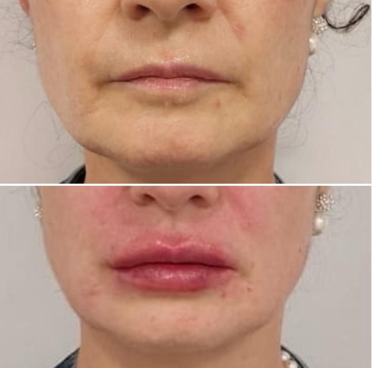 José Angel Molina Molero-0