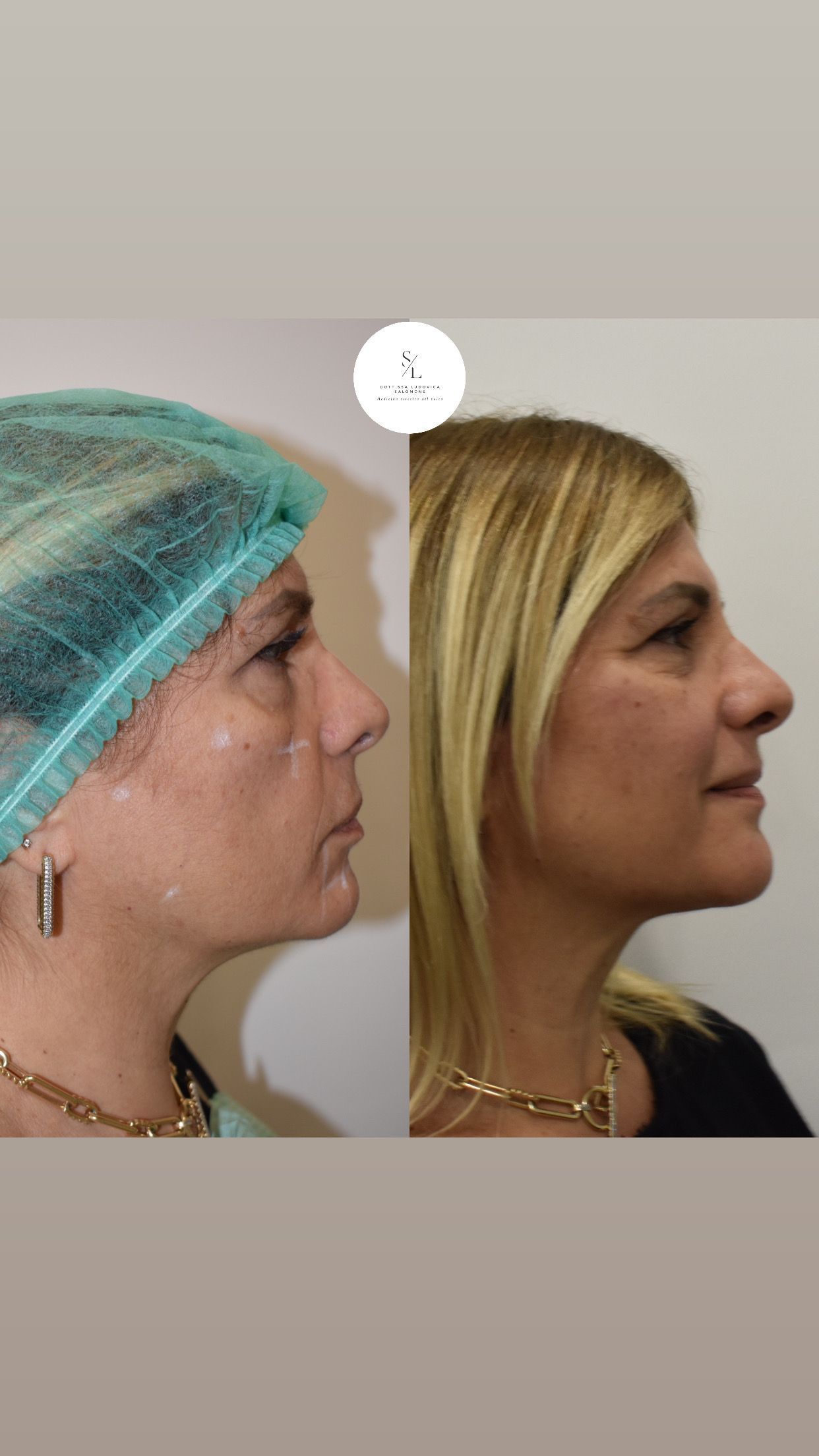 Ludovica Salomone-2