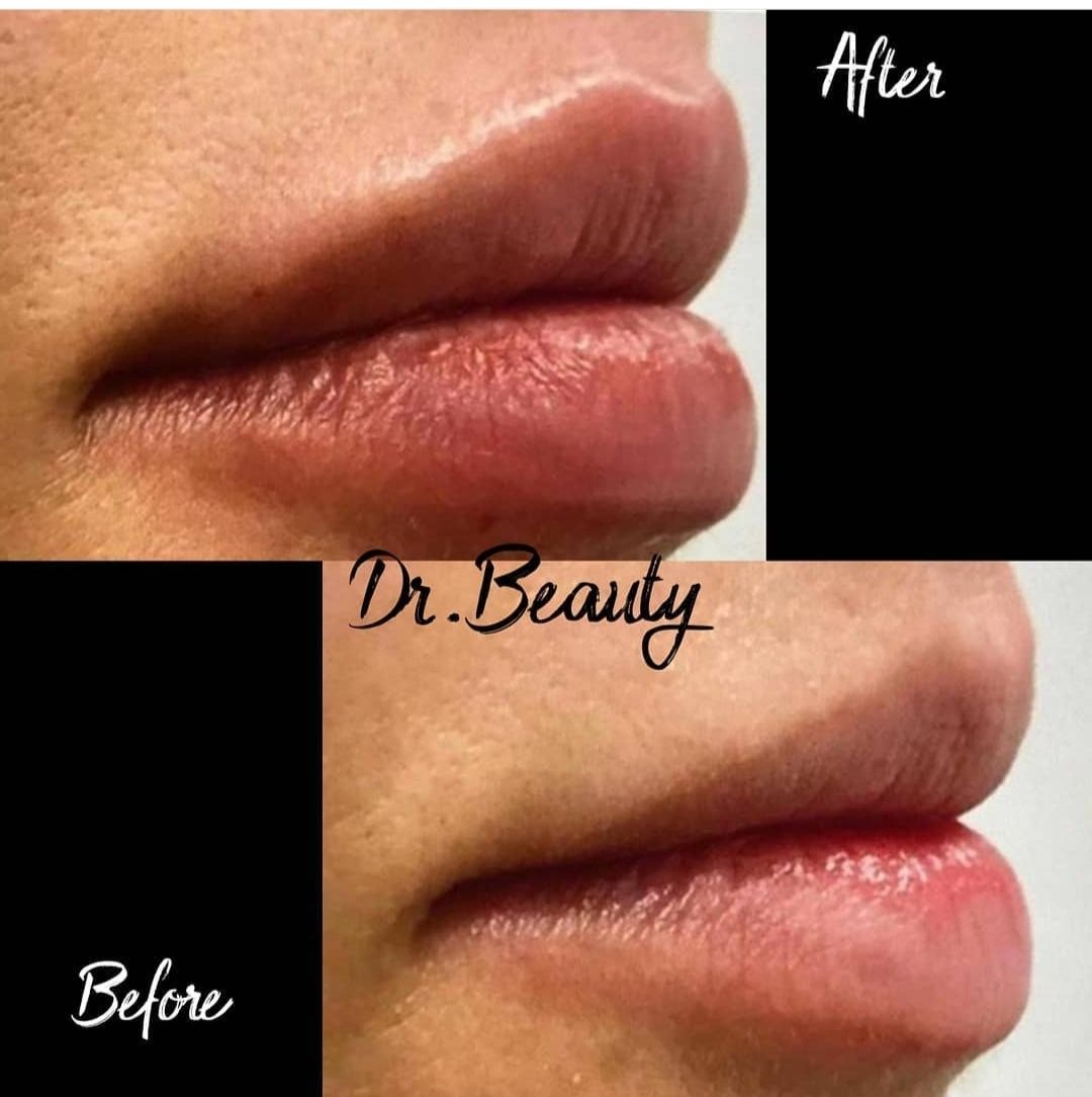 Giorgio Giovannelli-22