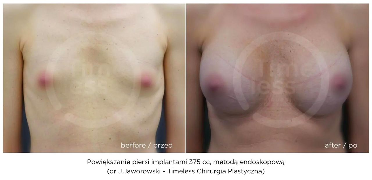 Janusz Jaworowski-119