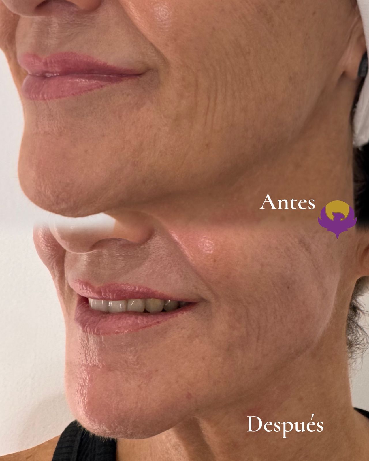 Yessica Corrales Acevedo-11