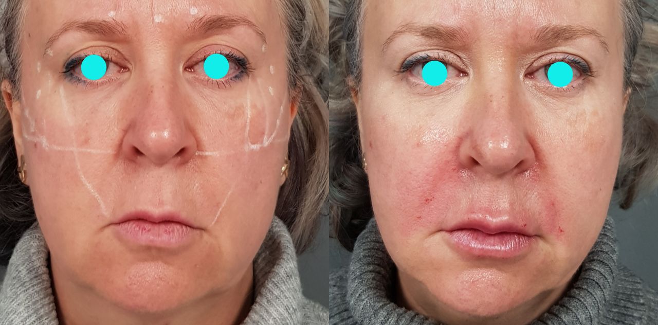 Rosalba Herrero Zerpa-122