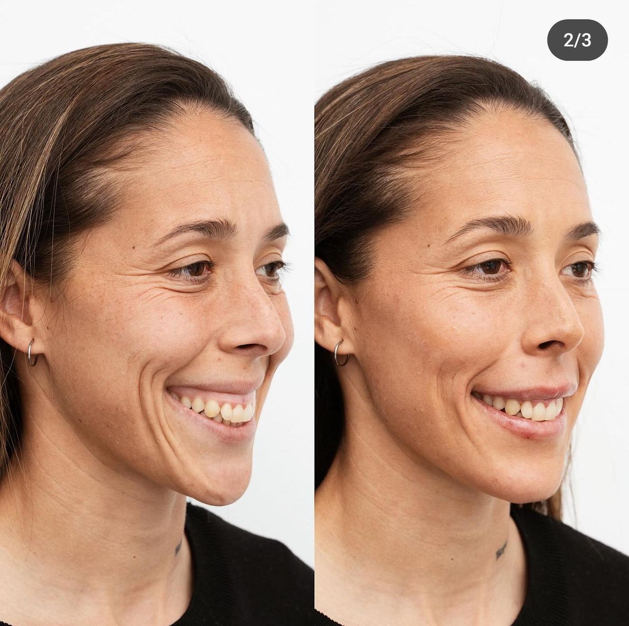 Raquel Moreno Pentinel-66