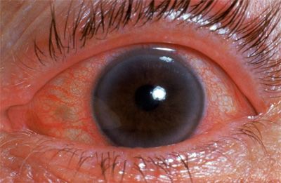 Lorenzo Grannonio-12