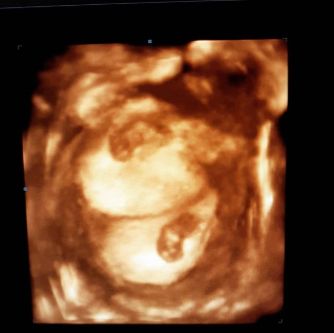 Hakan İbrahim Boyar-7