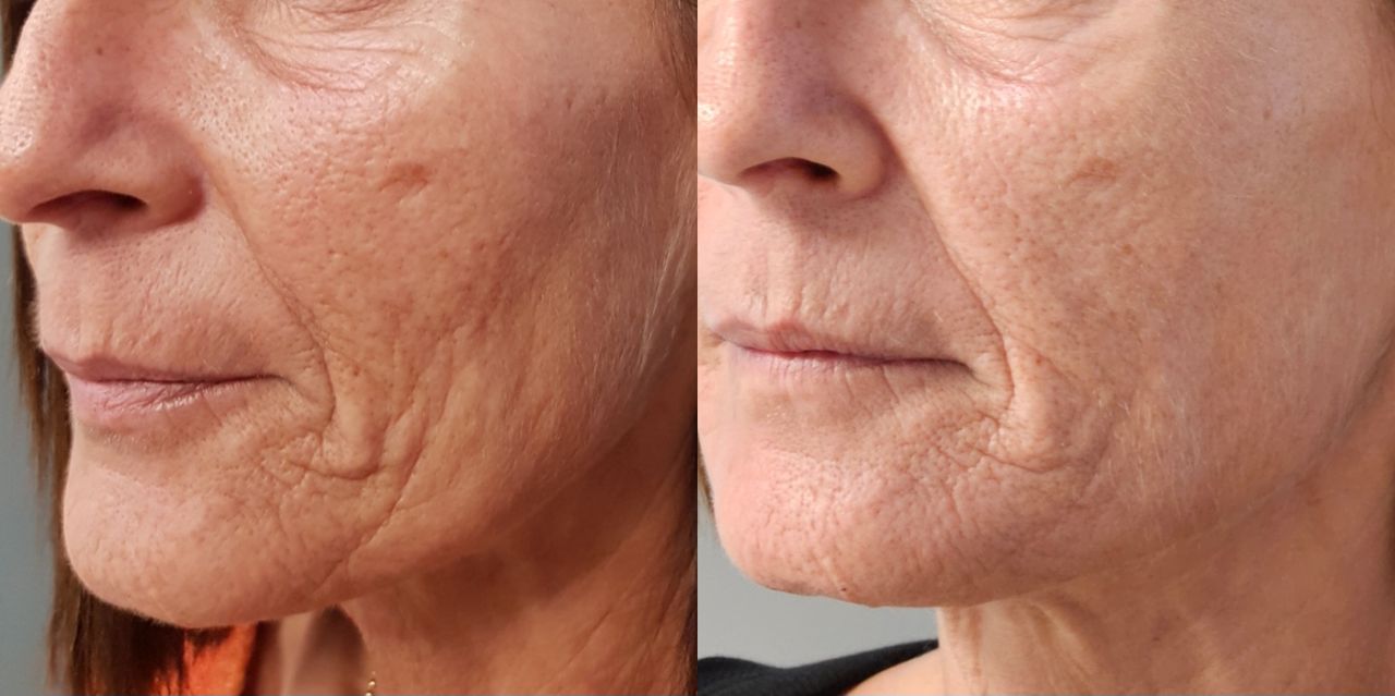 Rosalba Herrero Zerpa-577