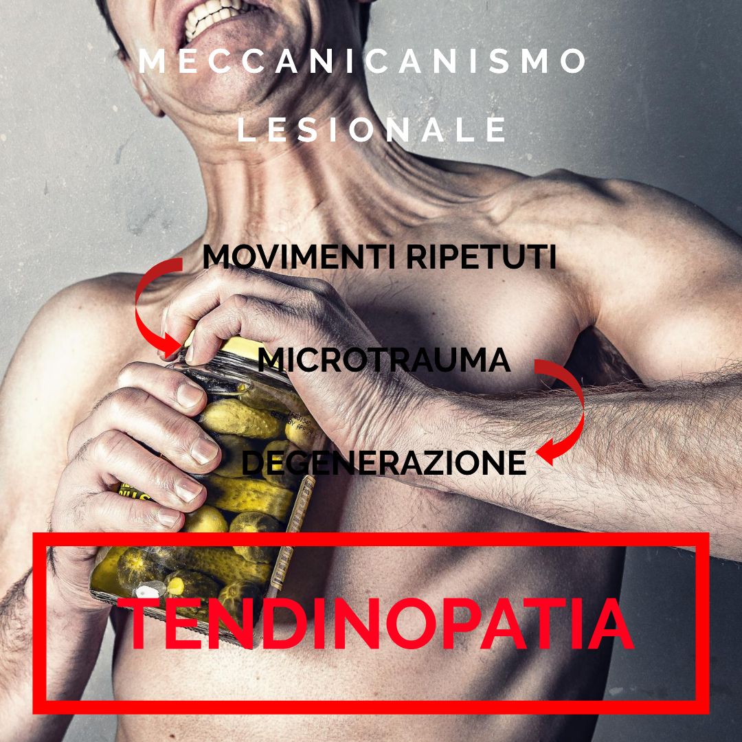 Tommaso Albertini-17