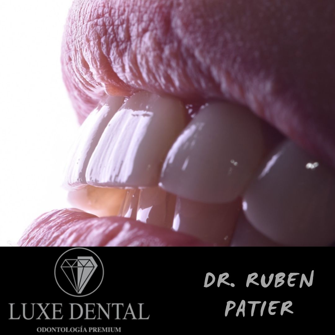 Ruben Patier Martin-31