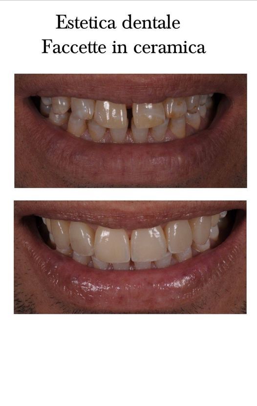 Saverio Giugliano-13