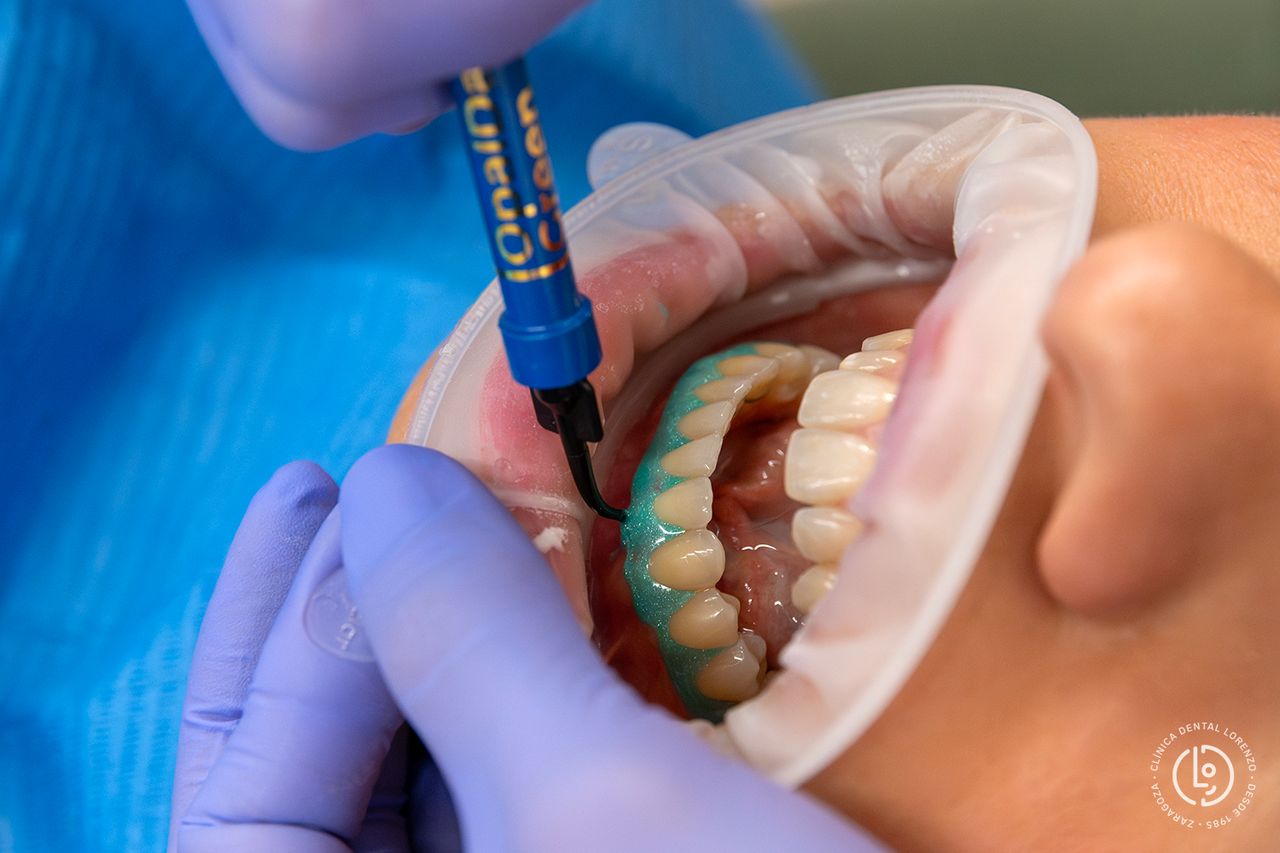 Dental Lorenzo Gabinete Higienes-5