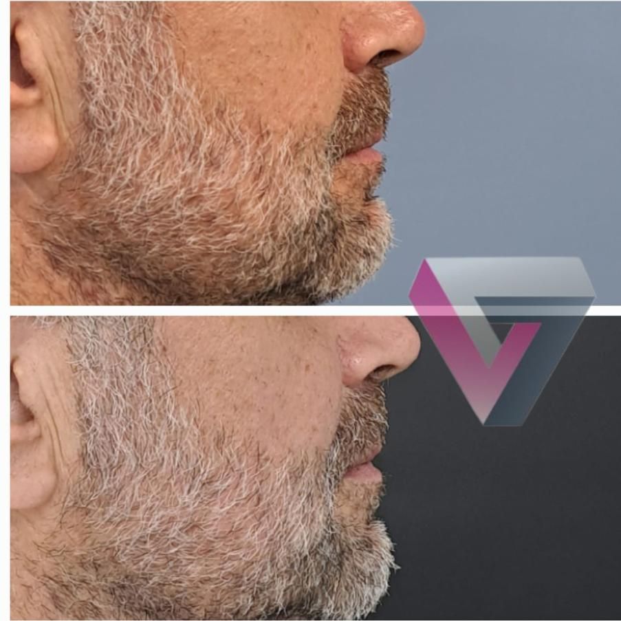 Victoria Trasmonte-101