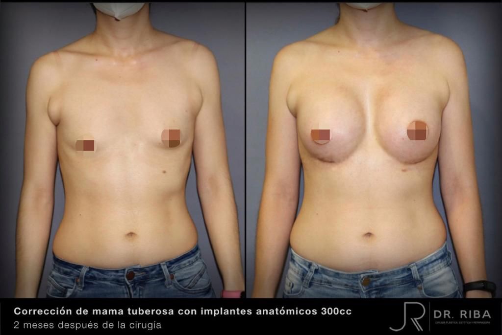 Jordi Riba Vilchez-13