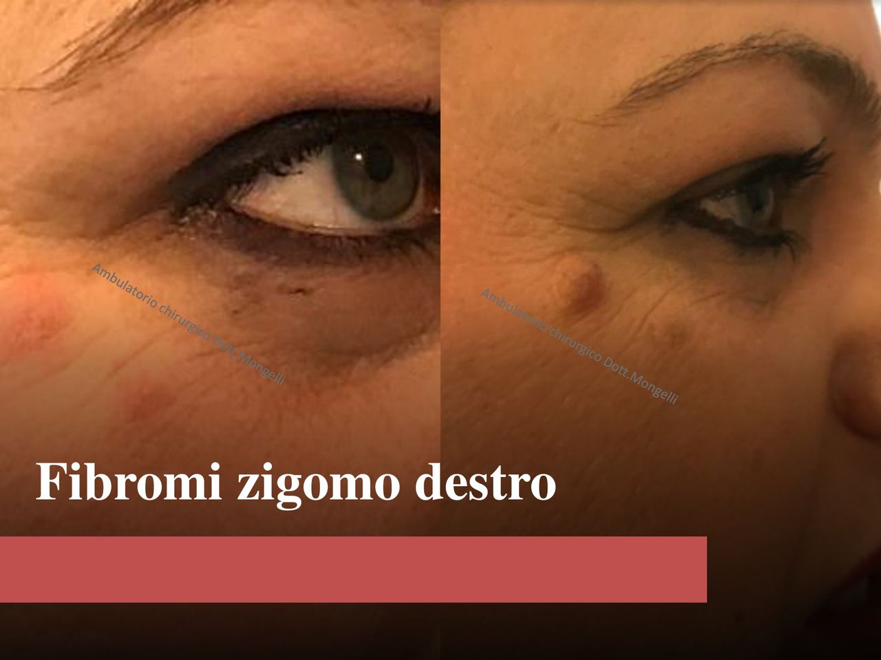 Matteo Antonio Mongelli-24