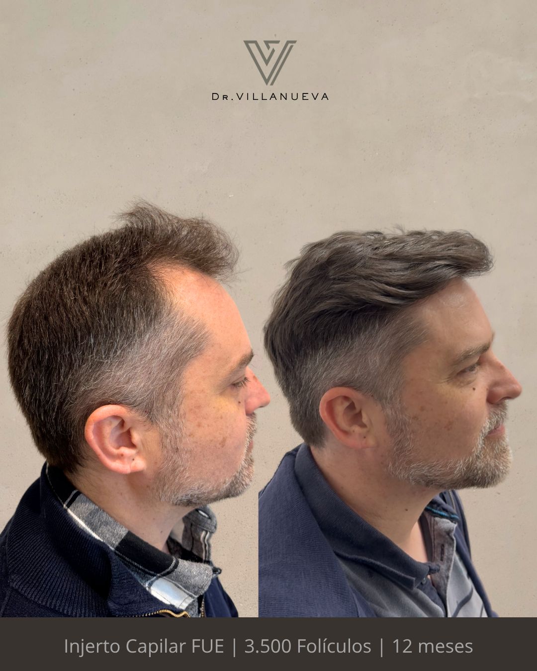 Alfredo Villanueva-3