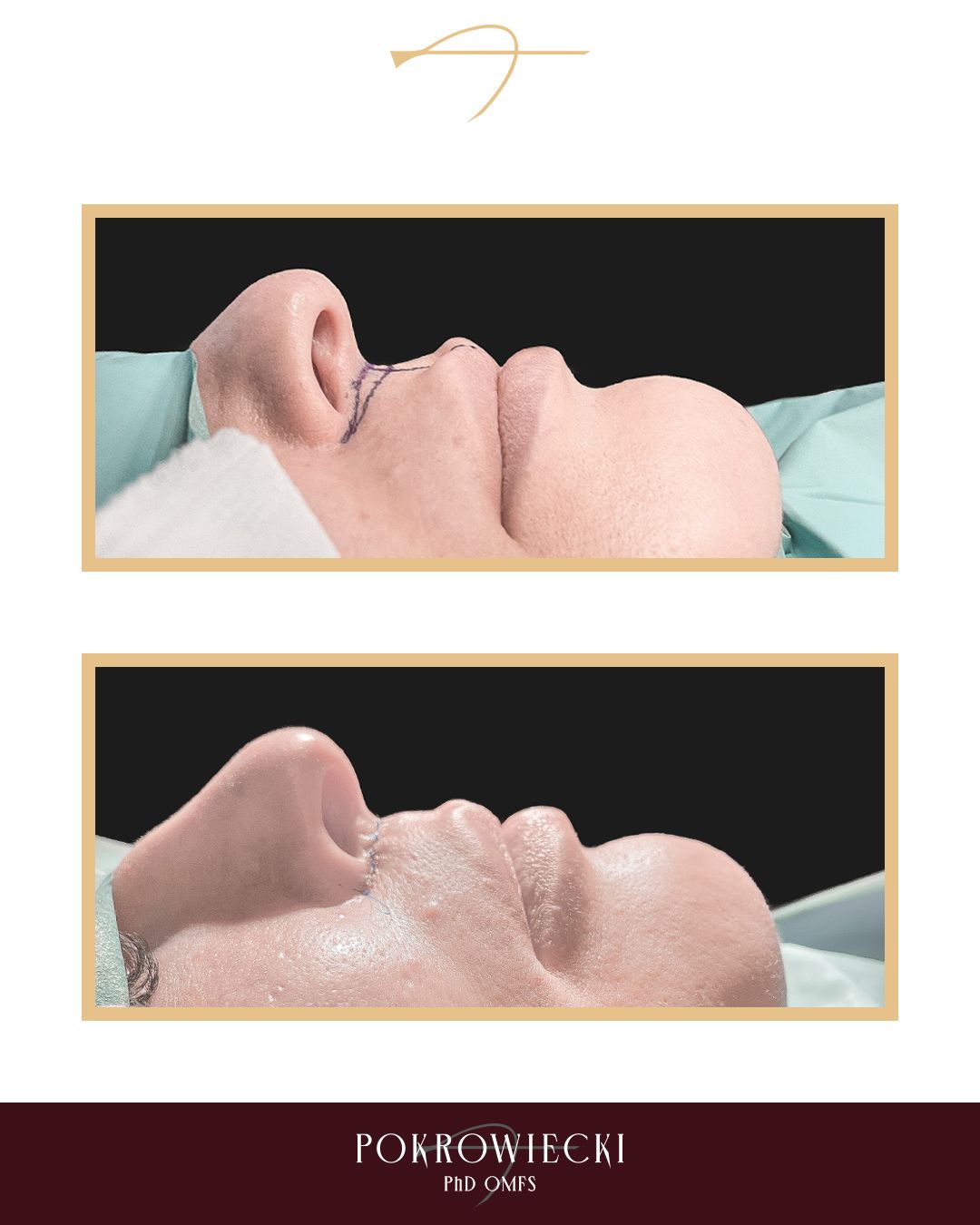 Rafał Pokrowiecki-37