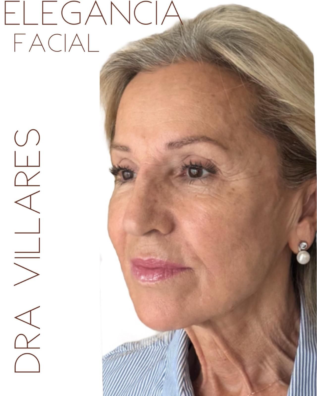 Maria Jose Villares Moreno-8