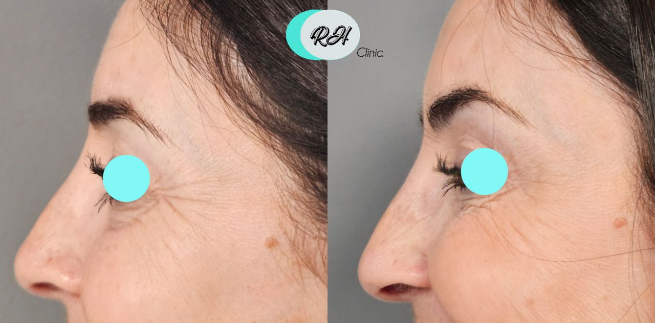 Rosalba Herrero Zerpa-607