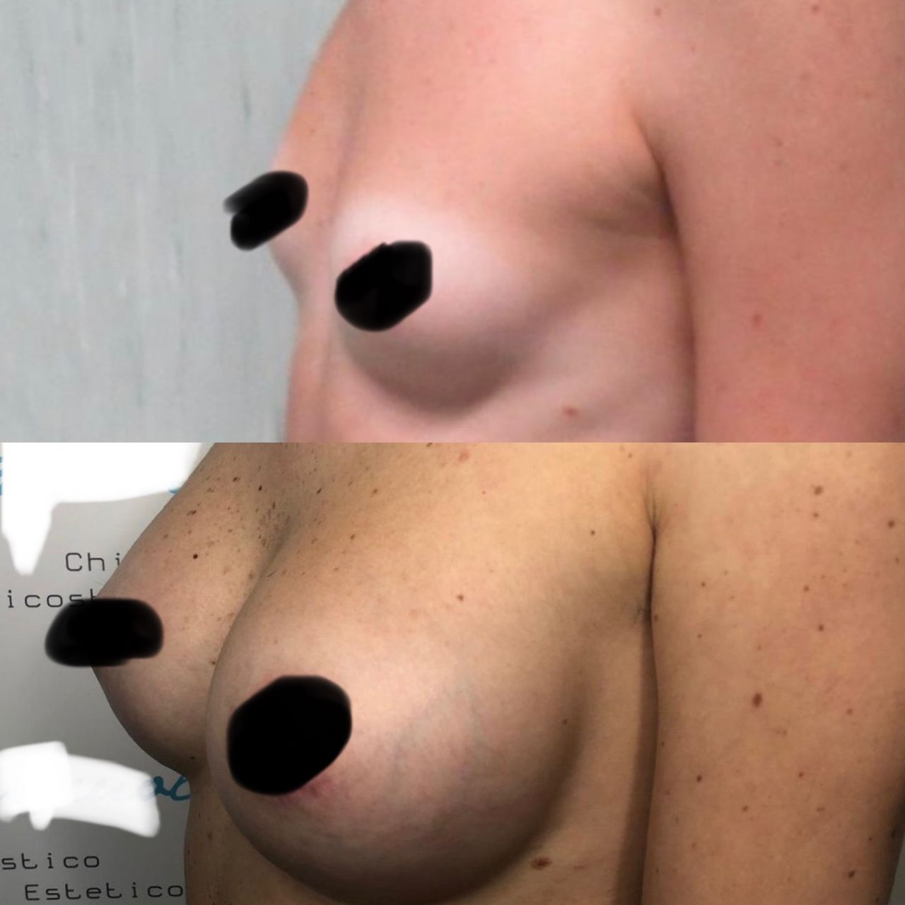 Antonio Napoletano-4