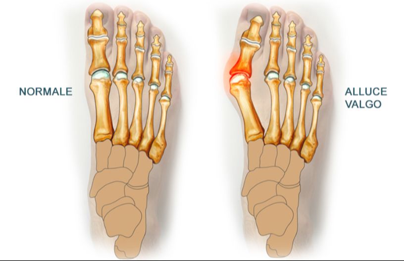 Francesca Montaquila-8